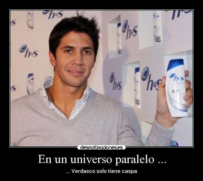 En un universo paralelo ... - ... Verdasco solo tiene caspa