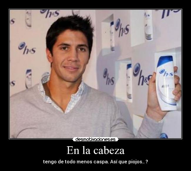 En la cabeza - tengo de todo menos caspa. Así que piojos.. ?