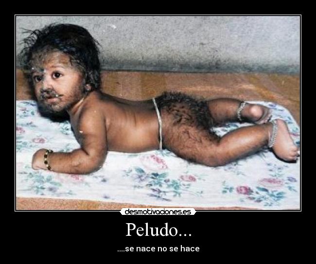 Peludo... - ....se nace no se hace