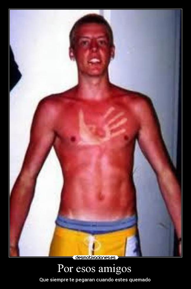 Por esos amigos  - Que siempre te pegaran cuando estes quemado 
