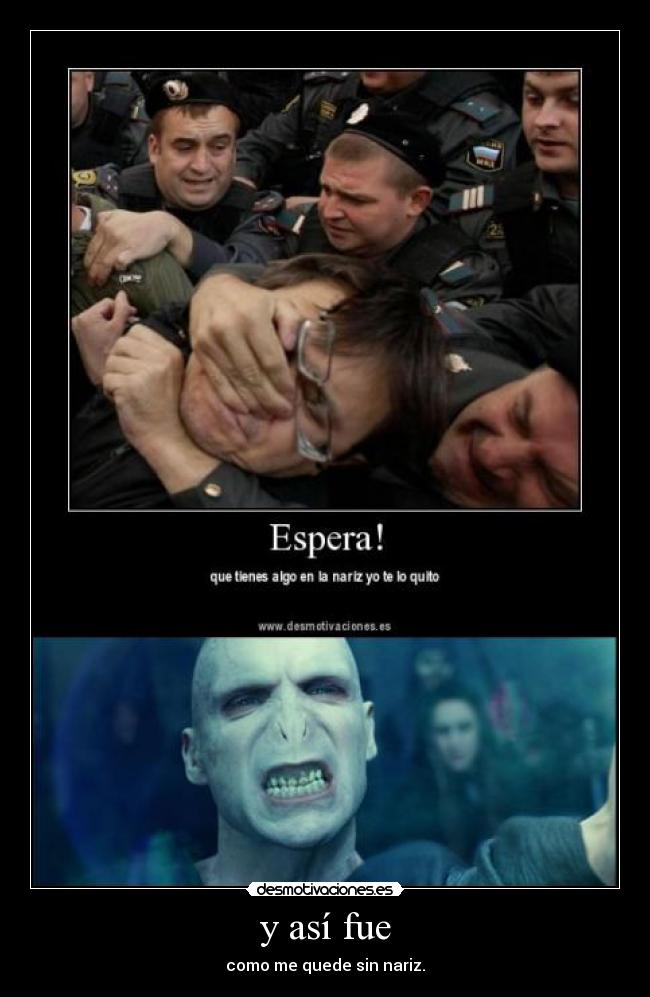 y así fue - como me quede sin nariz.