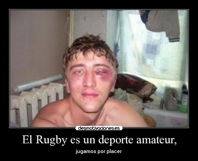 El Rugby es un deporte amateur, - 