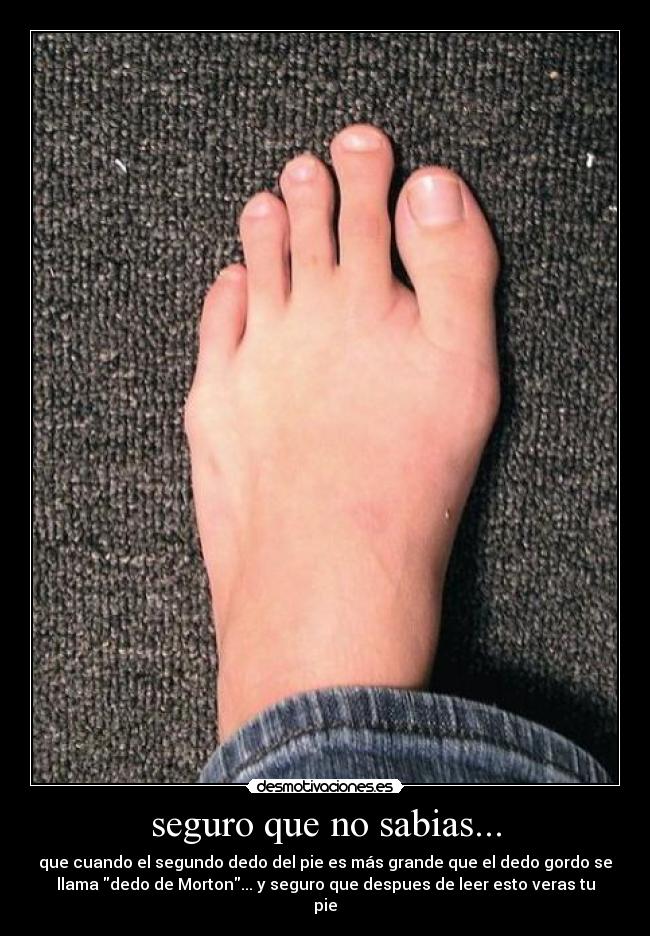 carteles pie dedo curiosidad morton raro desmotivaciones