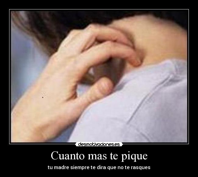 Cuanto mas te pique - tu madre siempre te dira que no te rasques