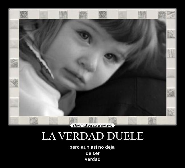 LA VERDAD DUELE - 
