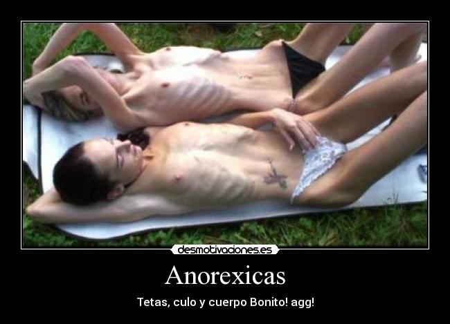 Anorexicas - 