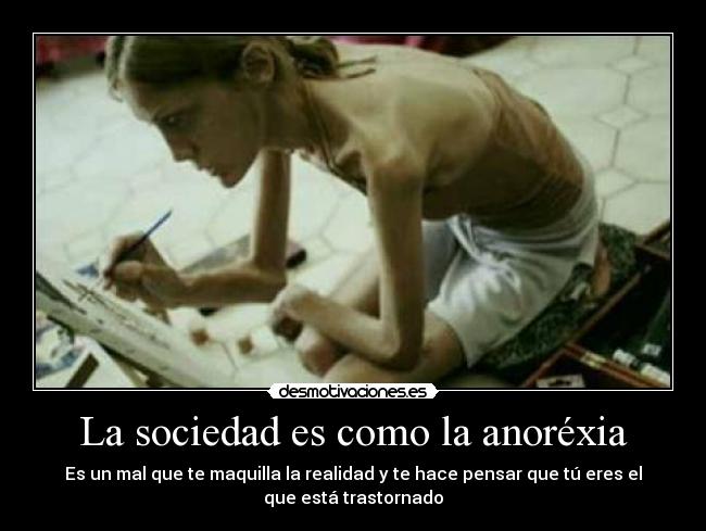 La sociedad es como la anoréxia -