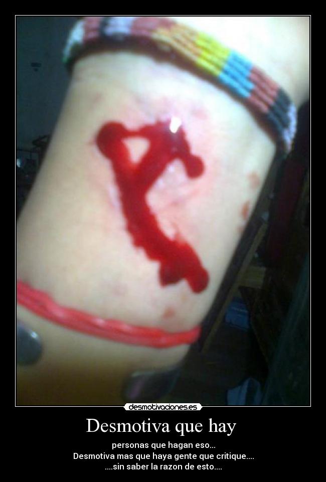 Desmotiva que hay - personas que hagan eso...
Desmotiva mas que haya gente que critique....
....sin saber la razon de esto....