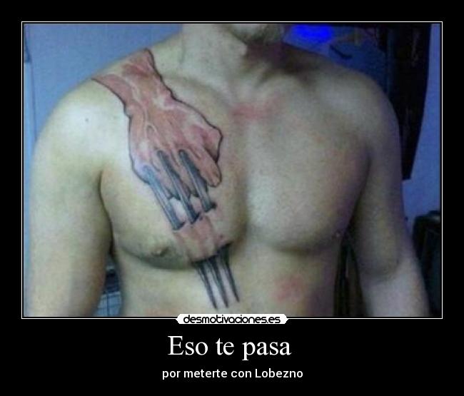 Eso te pasa - por meterte con Lobezno