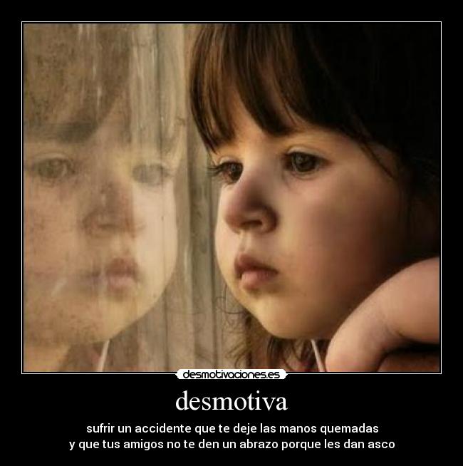 desmotiva - sufrir un accidente que te deje las manos quemadas
y que tus amigos no te den un abrazo porque les dan asco