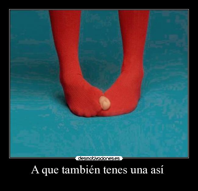 A que también tenes una así -