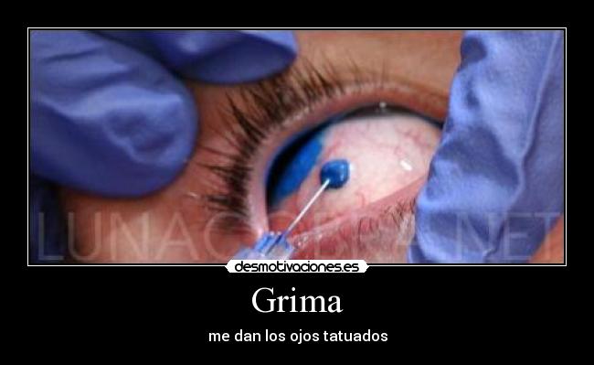Grima - 