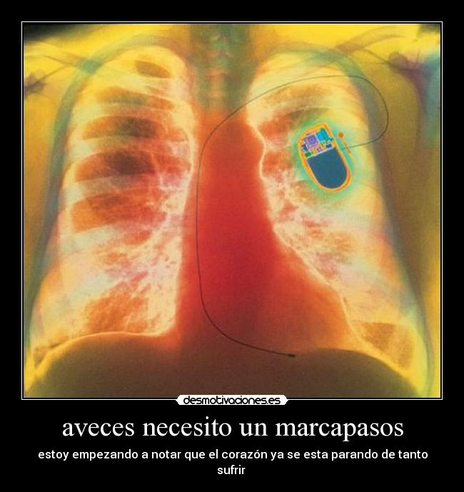 aveces necesito un marcapasos - estoy empezando a notar que el corazón ya se esta parando de tanto sufrir