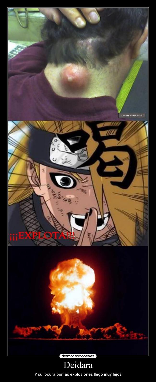 Deidara - Y su locura por las explosiones llego muy lejos