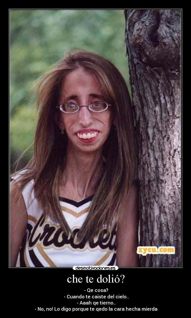 che te dolió? -