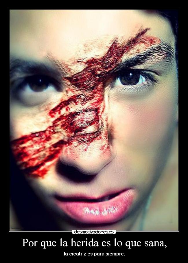 Por que la herida es lo que sana, - la cicatriz es para siempre.