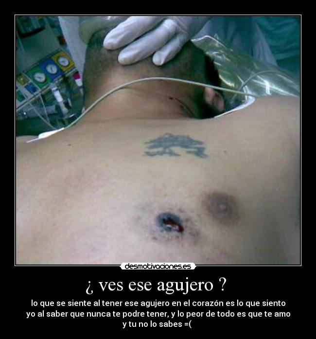 ¿ ves ese agujero ? -