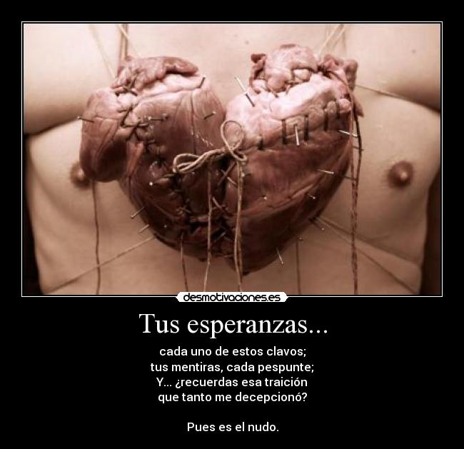 Tus esperanzas... - 