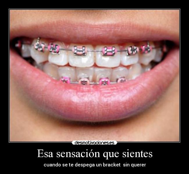 Esa sensación que sientes - 