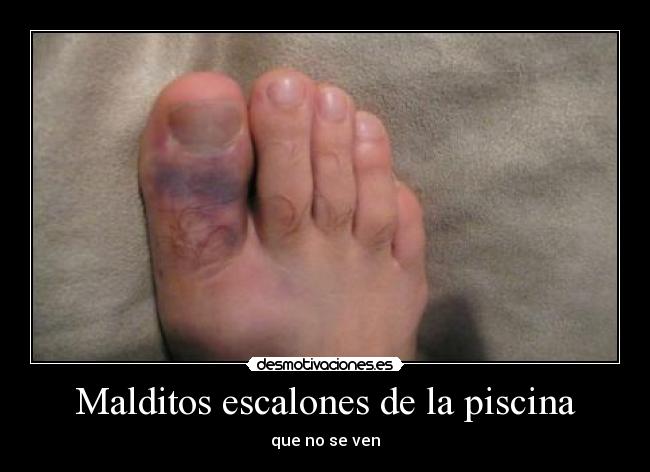 Malditos escalones de la piscina - 