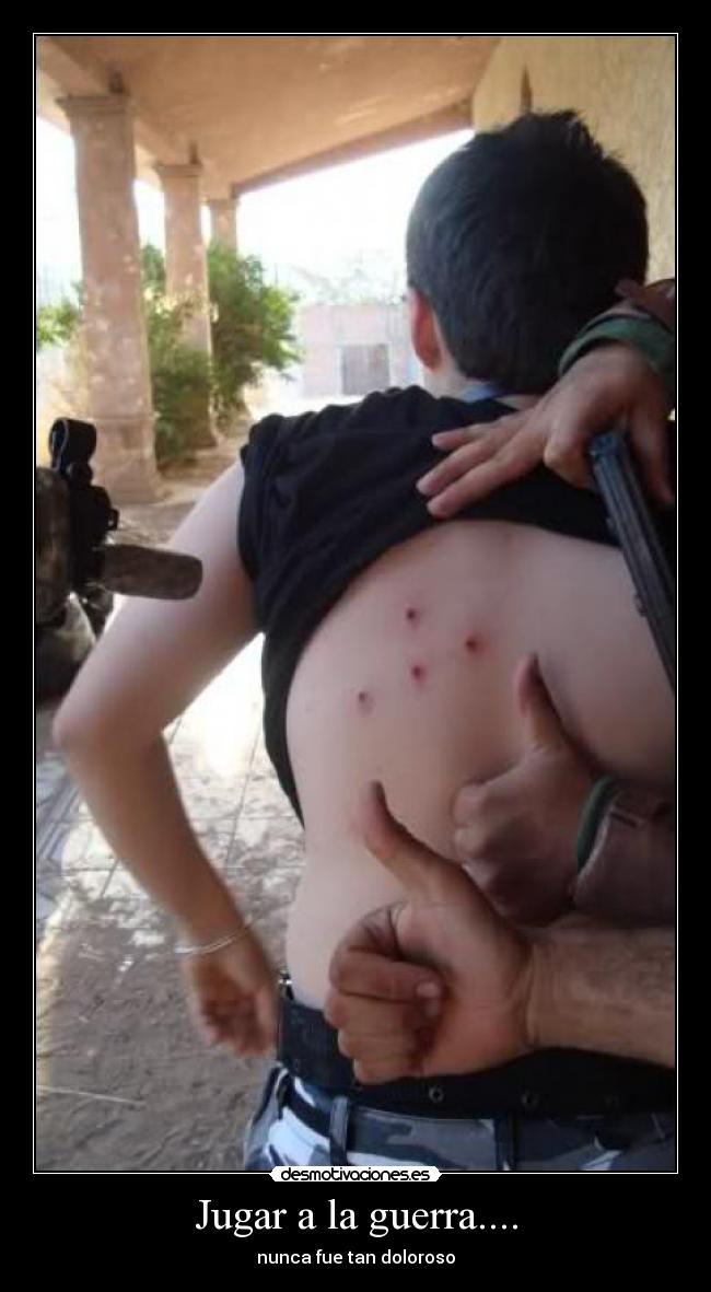 Jugar a la guerra.... - nunca fue tan doloroso