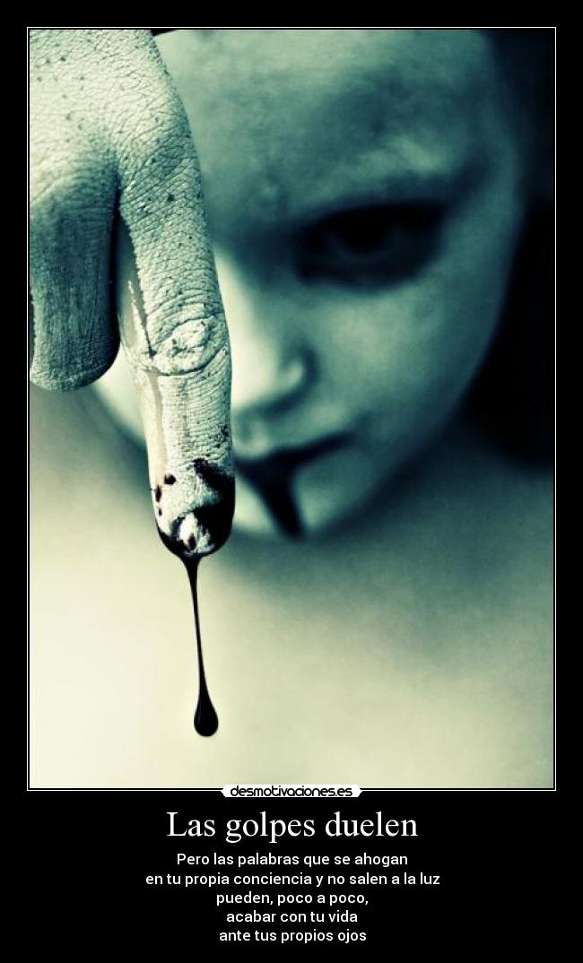 Las golpes duelen -