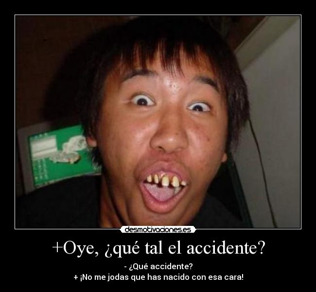 +Oye, ¿qué tal el accidente? - - ¿Qué accidente?
+ ¡No me jodas que has nacido con esa cara!