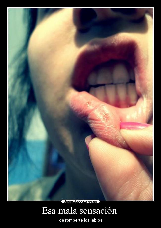 Esa mala sensación - de romperte los labios