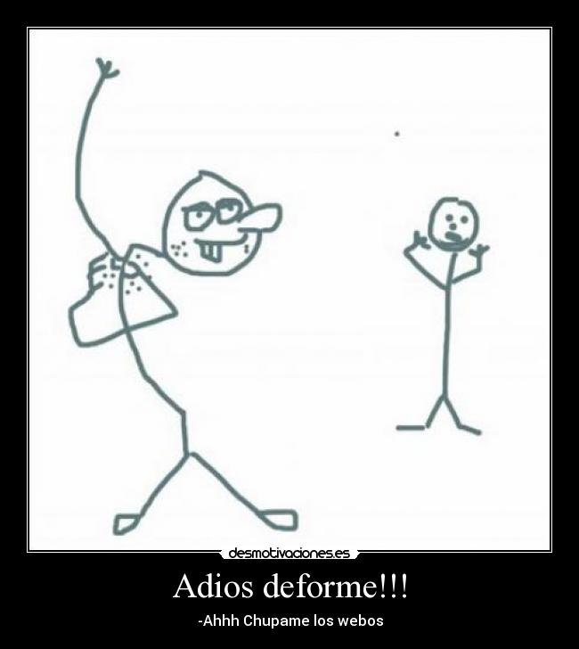 Adios deforme!!! -