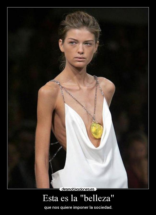 Esta es la belleza -