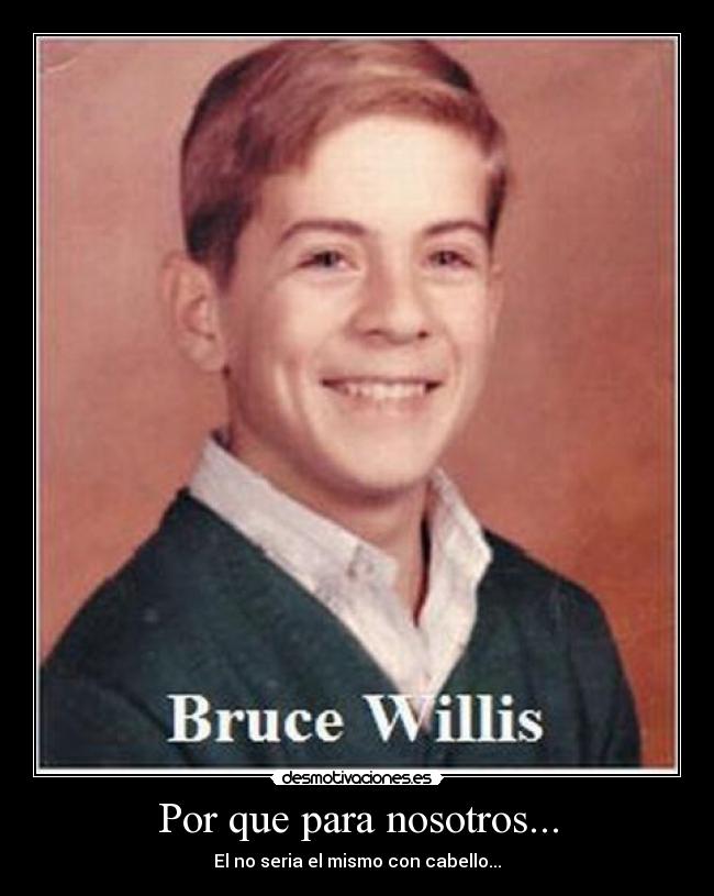 Por que para nosotros... - El no seria el mismo con cabello...