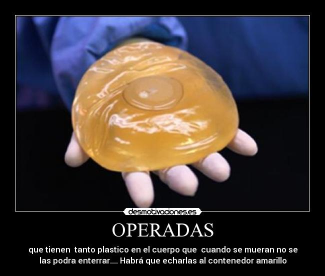 OPERADAS - que tienen  tanto plastico en el cuerpo que  cuando se mueran no se
las podra enterrar.... Habrá que echarlas al contenedor amarillo