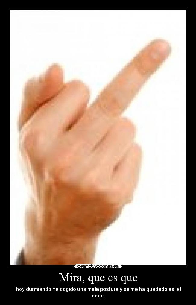 Mira, que es que - hoy durmiendo he cogido una mala postura y se me ha quedado así el dedo.