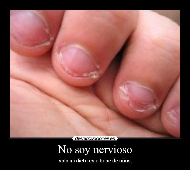 carteles nervioso unas desmotivaciones