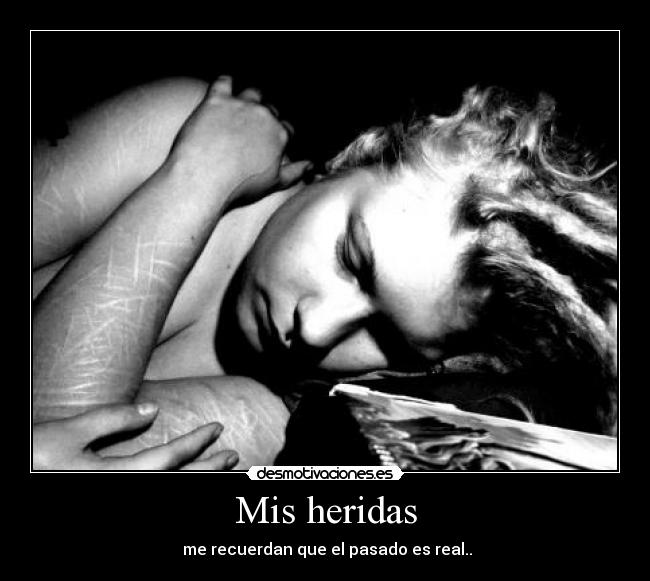Mis heridas - me recuerdan que el pasado es real..