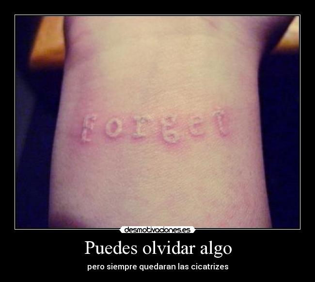 Puedes olvidar algo - pero siempre quedaran las cicatrizes