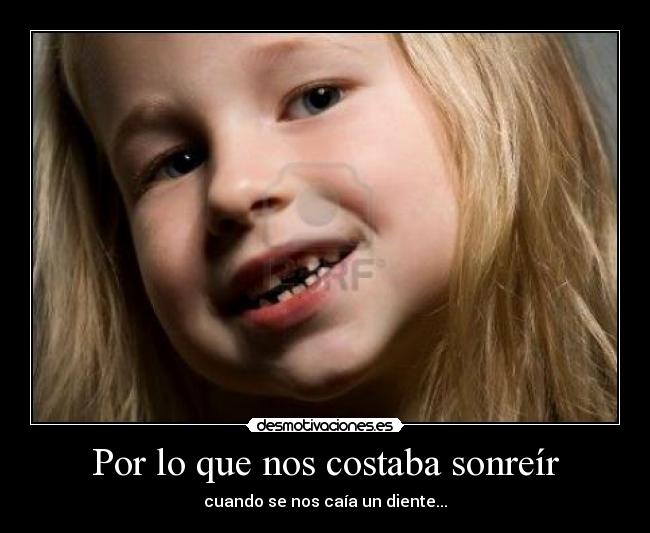 Por lo que nos costaba sonreír - cuando se nos caía un diente...