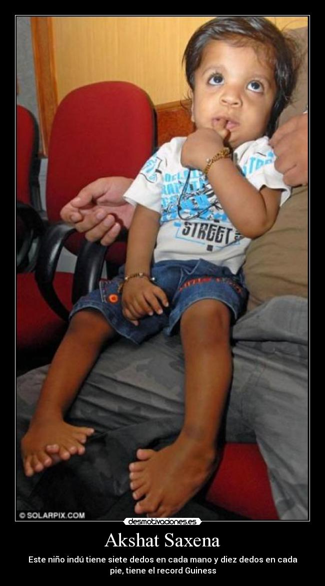 Akshat Saxena - Este niño indú tiene siete dedos en cada mano y diez dedos en cada
pie, tiene el record Guiness