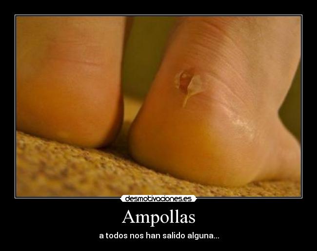 Ampollas - a todos nos han salido alguna...