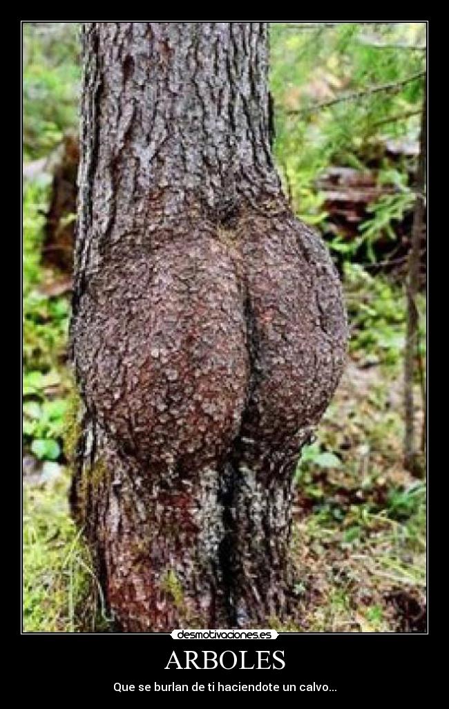 ARBOLES - 