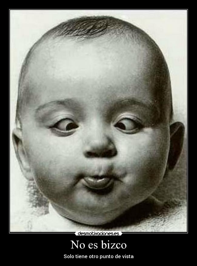 No es bizco -