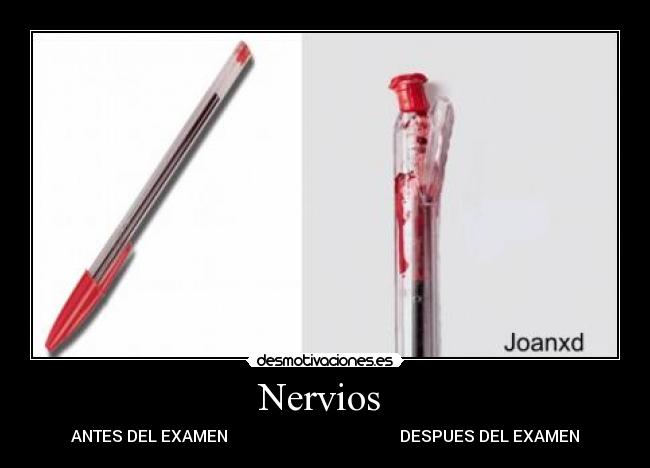Nervios -