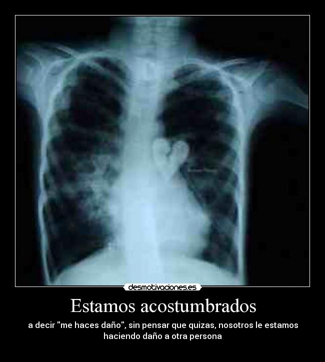 Estamos acostumbrados - 