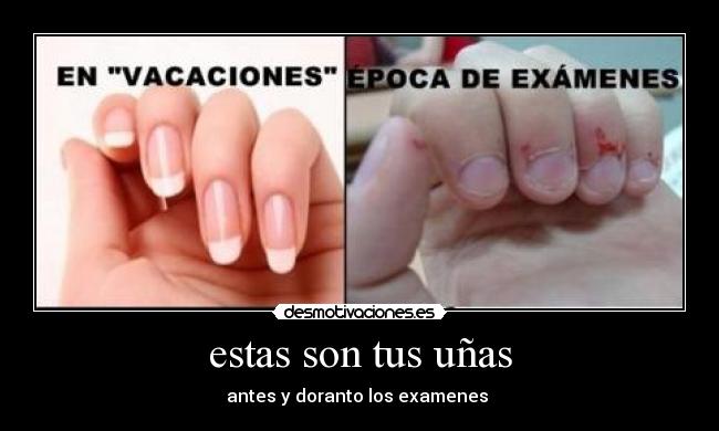 estas son tus uñas - 