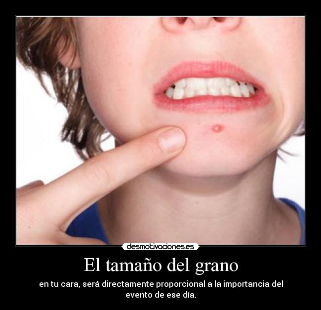 El tamaño del grano -