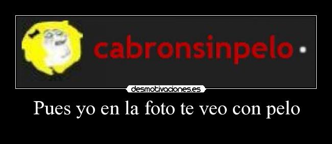 Pues yo en la foto te veo con pelo -