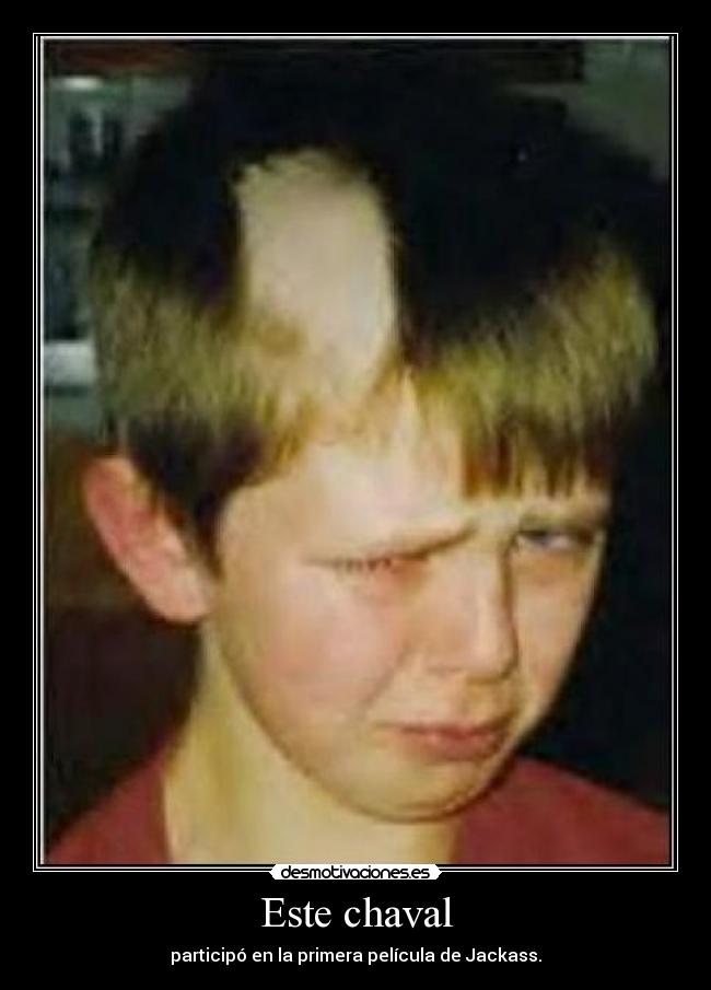 Este chaval - participó en la primera película de Jackass.