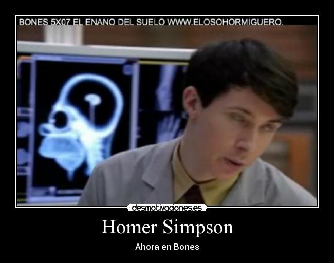 Homer Simpson - Ahora en Bones