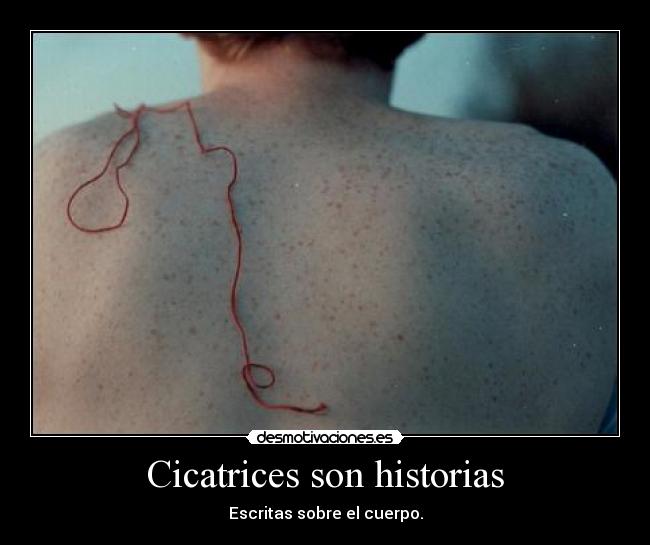 Cicatrices son historias - Escritas sobre el cuerpo.