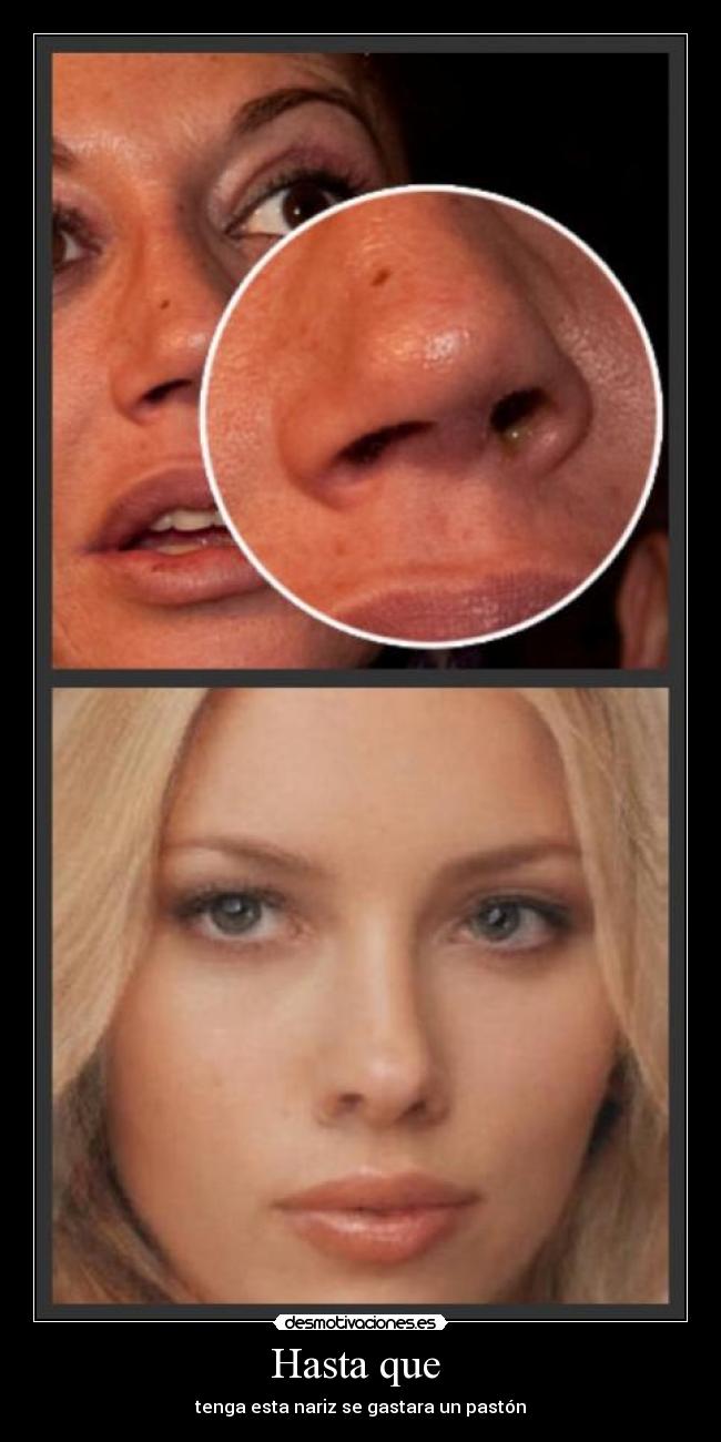 Hasta que  - tenga esta nariz se gastara un pastón